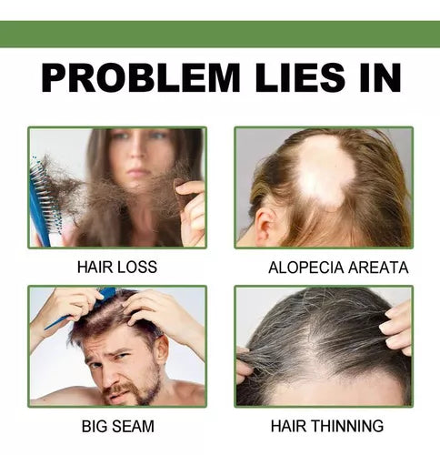 ACEITE SERUM CRECIMIENTO DE CABELLO