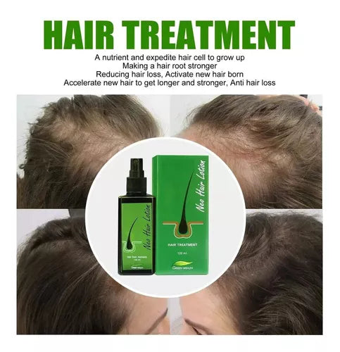 ACEITE SERUM CRECIMIENTO DE CABELLO